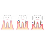 Zahnbeschwerden